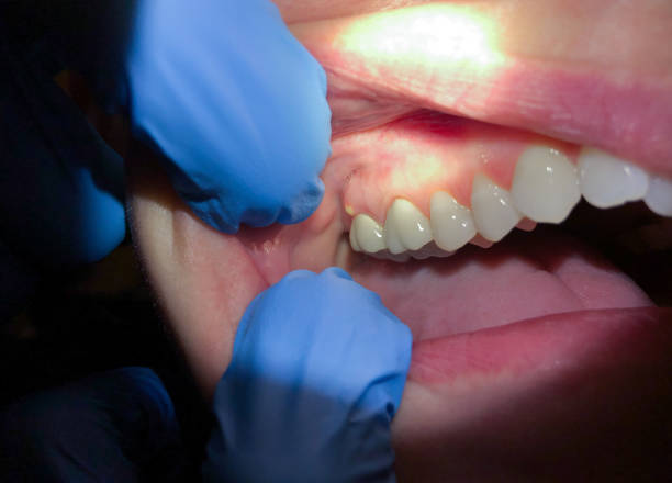 Best Emergency Treatment for Toothache in Robinson, IL